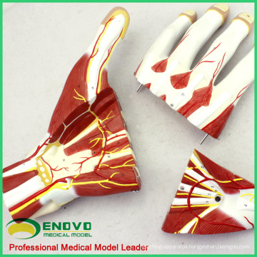 MUSCLE09(12032) Hand Sectional Anatomy of Nerves and Blood Vessels Model, Human Anatomy Model of Hand 12032